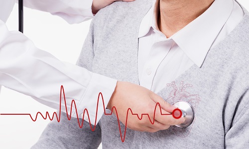 心率變異分析儀