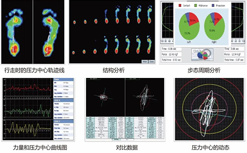 足底壓力分析系統(tǒng)